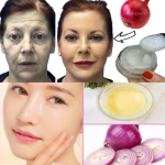 Discover the Natural Wrinkle-Reducing Powers of Onion