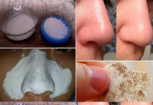 Use A Few Ingredients, They Will Help You Say Goodbye To Big Pores