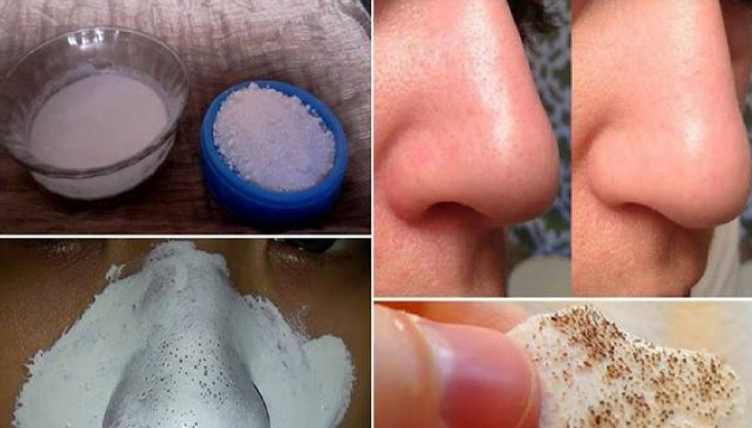 Use A Few Ingredients, They Will Help You Say Goodbye To Big Pores