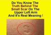 Do You Know The Real Significance Of The Small Scar