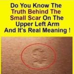 Do You Know The Real Significance Of The Small Scar