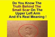 Do You Know The Real Significance Of The Small Scar