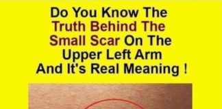 Do You Know The Real Significance Of The Small Scar