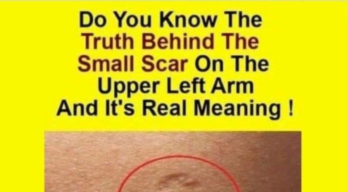 Do You Know The Real Significance Of The Small Scar