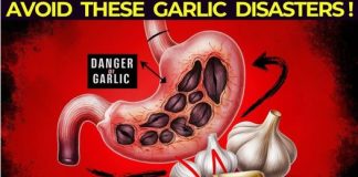 Garlic Usage Tips: Avoid These Common Errors