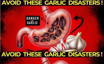 Garlic Usage Tips: Avoid These Common Errors
