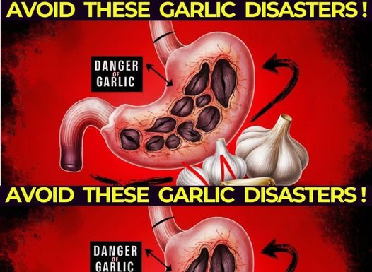 Garlic Usage Tips: Avoid These Common Errors