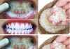 Unlock a Brighter Smile: The Natural Power of Baking Soda