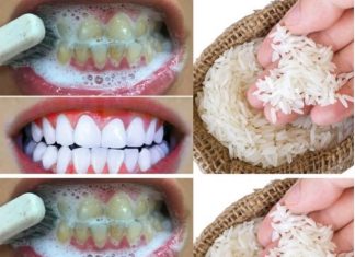 Unlock a Brighter Smile: The Natural Power of Baking Soda