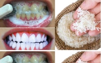 Unlock a Brighter Smile: The Natural Power of Baking Soda