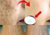 Lighten Age Spots at Home with Baking Soda: A Natural and Effective Remedy