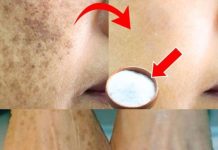Lighten Age Spots at Home with Baking Soda: A Natural and Effective Remedy