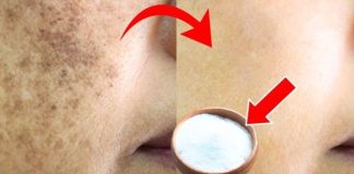 Lighten Age Spots at Home with Baking Soda: A Natural and Effective Remedy