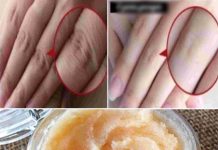 Revitalize Your Hands Overnight: Coconut Oil and Sugar Scrub for