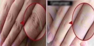 Revitalize Your Hands Overnight: Coconut Oil and Sugar Scrub for