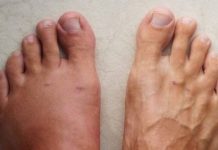 A month before a heart attack, your body will warn you of these 7 signs.