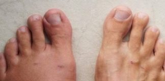 A month before a heart attack, your body will warn you of these 7 signs.