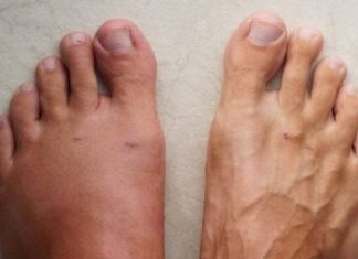 A month before a heart attack, your body will warn you of these 7 signs.