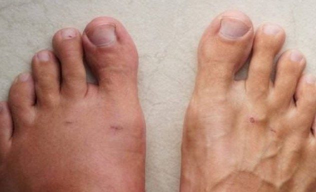 A month before a heart attack, your body will warn you of these 7 signs.