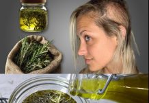 I Didn’t Expect This! The Hair on My Bald Spot is Growing Like Crazy! 100% Efficiency!