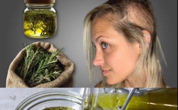 I Didn’t Expect This! The Hair on My Bald Spot is Growing Like Crazy! 100% Efficiency!