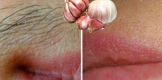 Explore the Natural Benefits of Garlic for Hair Removal