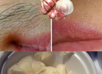Explore the Natural Benefits of Garlic for Hair Removal