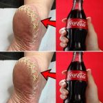 Achieve Beautiful Feet with This DIY Whitening and Healing Treatment
