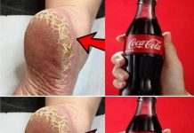 Achieve Beautiful Feet with This DIY Whitening and Healing Treatment