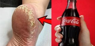 Achieve Beautiful Feet with This DIY Whitening and Healing Treatment