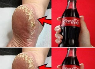 Achieve Beautiful Feet with This DIY Whitening and Healing Treatment