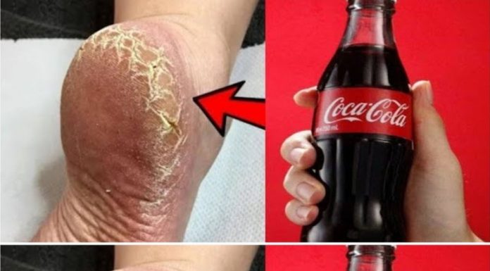 Achieve Beautiful Feet with This DIY Whitening and Healing Treatment