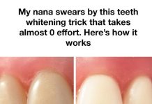The Secret to Radiant Teeth: Grandma’s Timeless Baking Soda Method