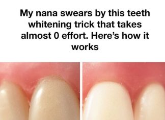 The Secret to Radiant Teeth: Grandma’s Timeless Baking Soda Method