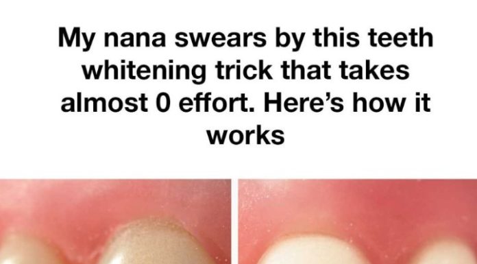 The Secret to Radiant Teeth: Grandma’s Timeless Baking Soda Method