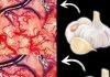 Take Garlic, But Don’t Make the Same Mistake Many People Do