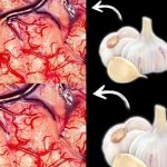 Take Garlic, But Don’t Make the Same Mistake Many People Do
