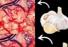 Take Garlic, But Don’t Make the Same Mistake Many People Do