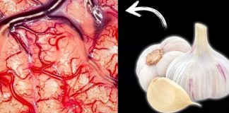 Take Garlic, But Don’t Make the Same Mistake Many People Do