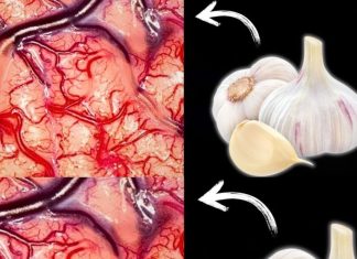 Take Garlic, But Don’t Make the Same Mistake Many People Do