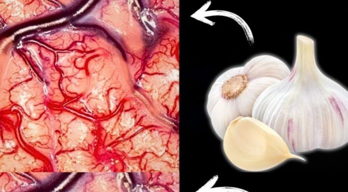 Take Garlic, But Don’t Make the Same Mistake Many People Do