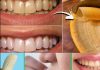The Hidden Dental Secret: How Banana Peels Can Remove Tartar and Whiten Teeth in Just 2 Minutes!