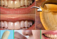 The Hidden Dental Secret: How Banana Peels Can Remove Tartar and Whiten Teeth in Just 2 Minutes!