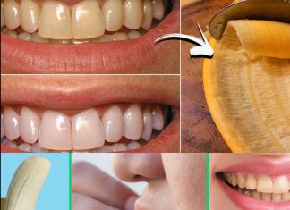 The Hidden Dental Secret: How Banana Peels Can Remove Tartar and Whiten Teeth in Just 2 Minutes!