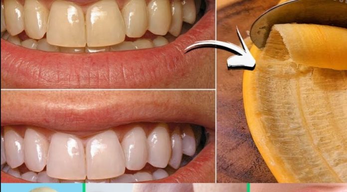 The Hidden Dental Secret: How Banana Peels Can Remove Tartar and Whiten Teeth in Just 2 Minutes!