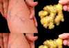 Natural Remedies for Varicose Veins: Simple Solutions for Healthier Legs.