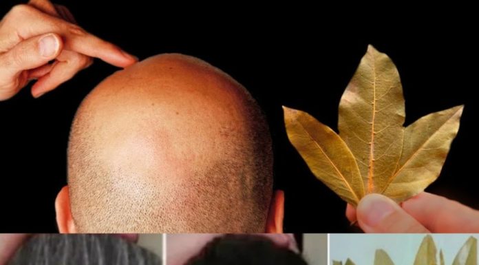 Unbelievable Bay Leaves for Hair Growth