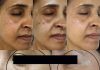 This Vitamin Removes Age Spots Permanently (ALWAYS Works)