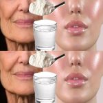 A Natural Collagen Face Lift