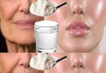 A Natural Collagen Face Lift